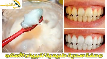 “يلا بيض أسنانك واضحك بدون إحراج” وصفة سحرية طبيعية لتبييض الأسنان بدون أي مواد كيميائية ضارة!