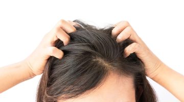 افضل الطرق الطبيعية لعلاج تساقط الشعر بعد البروتين
